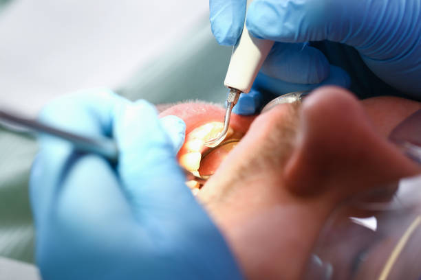 Best Broken or Cracked Tooth Emergency Dentist in Wilkinson Heights, SC